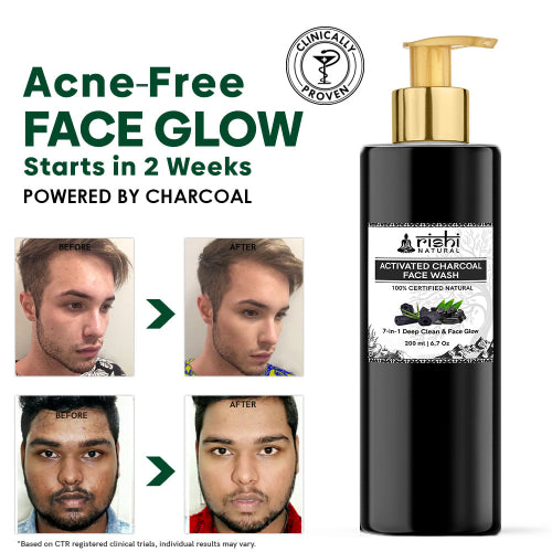 Rishi Natural Activated Charcoal Facewash Before and After
