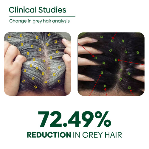 Rishinatural Grey Hair Shampoo Clinical Studies
