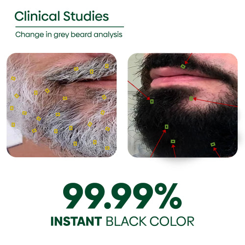 Rishinatural Beard Black Color Clinical Studies