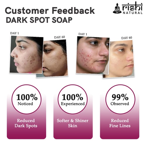 visible results of Rishi natural dark spot soap