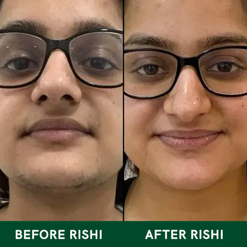 Before and After Rishi Natural Facial Hair Tea