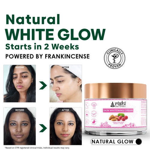 Rishi Natural Skin Whitening Cream Before and After